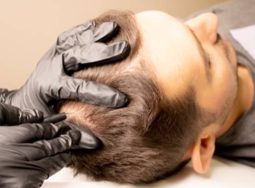 natural transplants hair restoration clinic