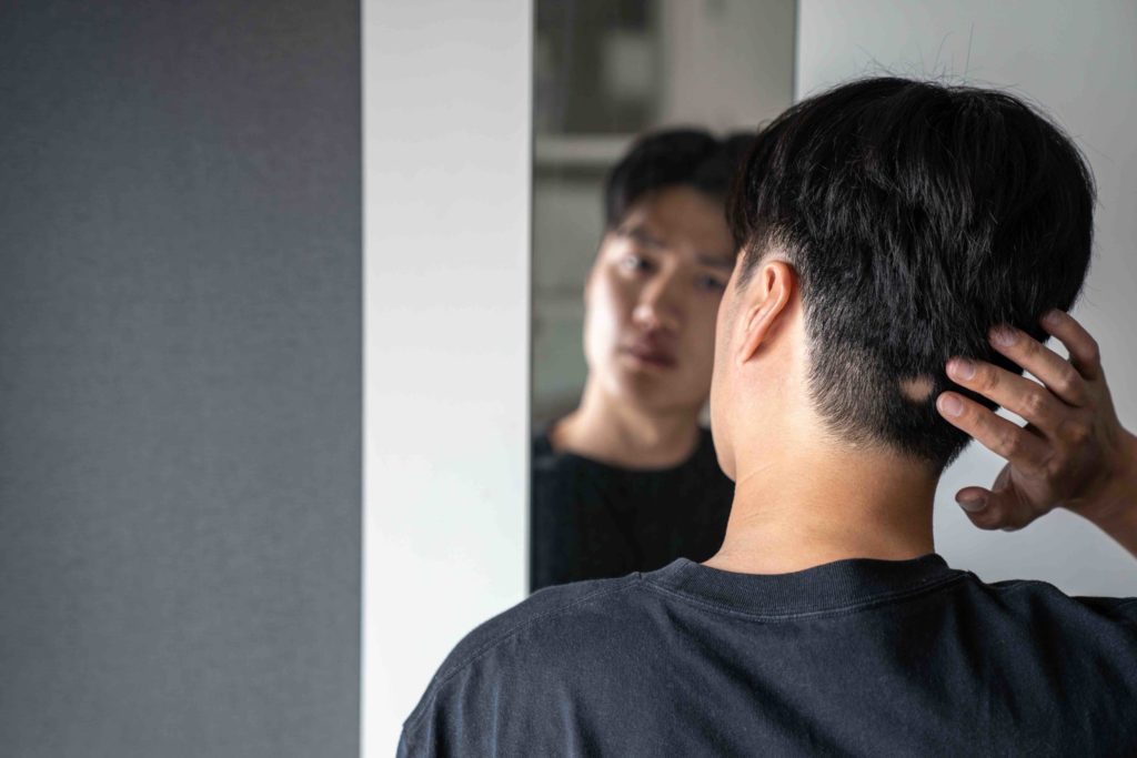 Young Asian man looking at his reflection, noticing he has Alopecia Areata, and is missing a patch of hair on the back of his head in New Jersey