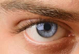 After receiving an eyebrow transplant, a person’s blue eye looks at the camera from underneath a full eyebrow.
