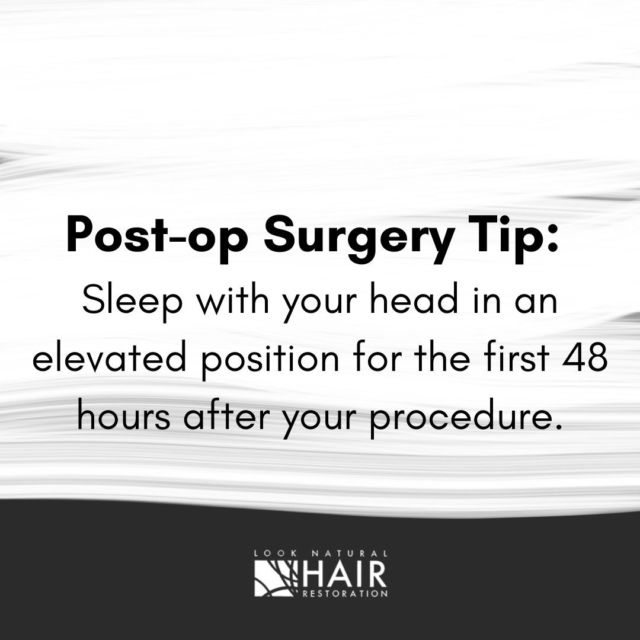 A very important post-op hair transplant surgery tip: sleep with your head in an elevated position for the first 48 hours after your procedure. This will help minimize the chance of post op swelling. Other helpful tips are to use ice packs on your forehead and minimize any activity in the immediate post-op period.

.
.
.
.
.

#hairreplacement #surgerytips #hairloss #hairline #hairlosssolution #hairlosstreatment #balding #scalpmicropigmentation #hairpro #thinninghair #hairlosssolutions #nohair #hairlinerestoration #hairspecialist #hairlosshelp #hairfibers #hairlove #hairtransformation #hairinstagram #hairlosstreatments #femalehairloss #hairtreatment #scalppigmentation #looknaturalhairrestoration #newjersey #newyork