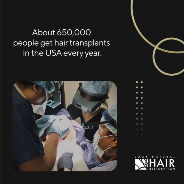 That’s 650,000 people who have been on the same journey and found renewed confidence in their aesthetic on the other side. Are you ready to get started with your journey, too?

.
.
.
.
.

#hairtransplant #hairrestoration #hairs #hairloss #haircare #hairgrowth #bald #hairlosssolution #hairlosstreatment #naturalhairstyles #healthyhair #hairlosssolutions #hairlosshelp #hairtransplantation #naturalhairjourney #hairjourney #hairline #hairreplacement #thinninghair #hairlossspecialist #beard #naturalhair #hairstyles #hair #hairstyle #love #naturalhairrestoration #newjersey #newyork