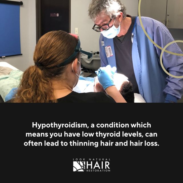 Hypothyroidism, a condition which means you have low thyroid levels, can often lead to thinning hair and hair loss. Some signs and symptoms might include fatigue, unexpected weight gain, dry skin, and feeling a higher sensitivity to cold. 

If you suspect you might be suffering from this condition, it’s important to have your thyroid levels checked. If they're low, replacement therapy is the best option. 

If your thyroid levels are normal and you're ready to explore your hair loss treatment options, we are ready to help you find the best solution. Contact our team today.

.
.
.
.
.

#hyperthyroidism #hairloss #hairtransplant #hairlosssolution #hairlosstreatment #hairlosshelp #hairtransplantation #thinninghair #hairreplacement #fuehairtransplant #looknaturalhairrestoration
