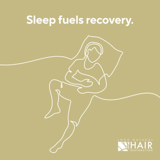 After an FUT or FUE, it's important to take some time off to recover. Resting, especially in the first 48 hours, gives a chance for scabs to form and lock in the grafts. Also, by resting, it gives your body a chance to focus its energy on healing as opposed to using energy expenditures elsewhere. 

Besides rest, good nutrition is important too so your body has the proper nutrients to build new tissues. So eat healthy, get plenty of rest and stay hydrated. These three simple things will put you on the easy road to recovery.

- Sleep in an elevated position
- Use clean bedsheets to prevent infection
- Cover your pillow with a clean towel 

Look Natural, Feel Confident

https://looknaturalhairrestoration.com/

#sleep #recovery #tips #looknaturalhairrestoration