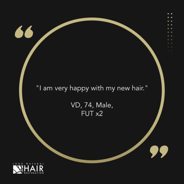 This patient had 2 FUT's performed by Dr. Ross. Direct & to the point about how he feels about his experience. 

#fut #hairtransplant #happypatients #clienttestimonial #looknaturalhairrestoration