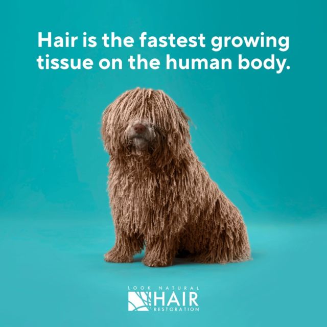 When you have healthy hair growth, you grow approximately 6 inches of hair annually. Surprised? Let us know your thoughts in the comments below. 

#hairgrowth #humantissue #hairregrowth #hairrestoration #looknaturalhairrestoration