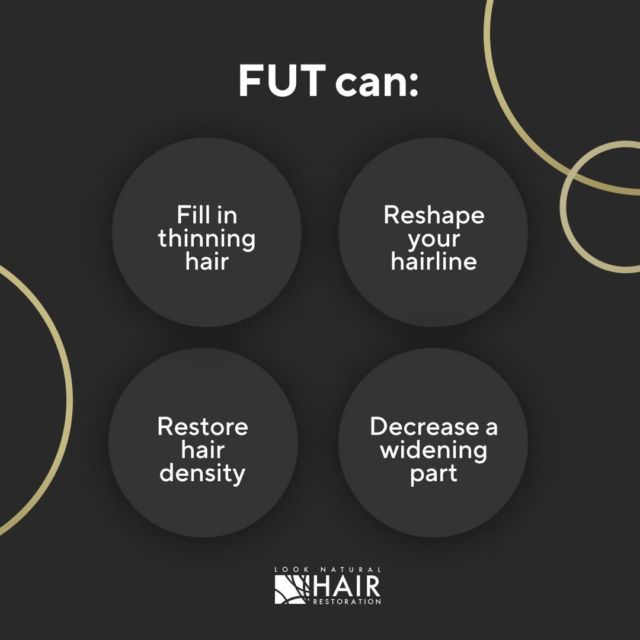 Looking to do any of these? With an FUT you can cross them off your list. First step: schedule a consultation with Dr. Ross (855) 802-4247. 

#FUT #thinninghair #hairlinehelp #hairrestoration #looknaturalhairrestoration