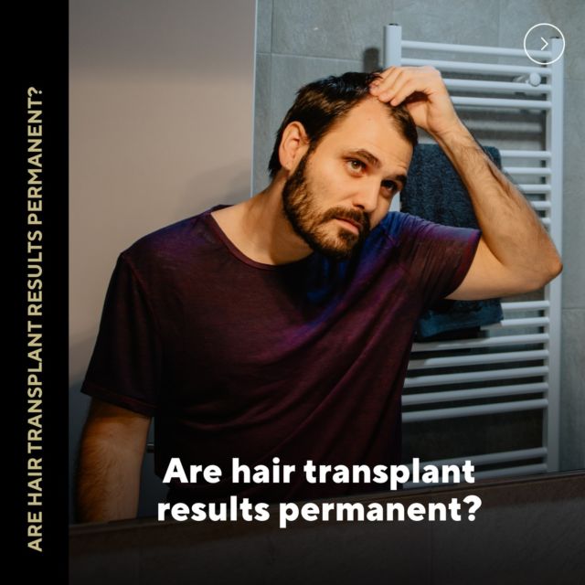 A common question from our patients: are hair transplant results permanent? Keep scrolling to find out 😉 or DM so Dr. Ross can answer your ❔s now.

#hairlossquestions #patientFAQ #hairlosssolutions #hairrestoration #looknaturalhairrestoration